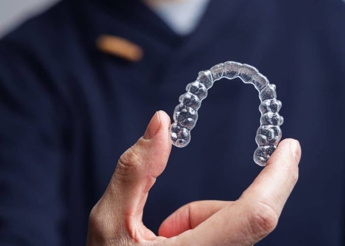Entenda-como-funciona-o-Invisalign
